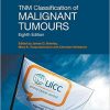 TNM Classification of Malignant Tumours  8 edition-Original PDF