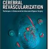 Cerebral Revascularization: Techniques in Extracranial-to-Intracranial Bypass Surgery: Expert Consult – Online and Print, 1e-Original PDF + Videos