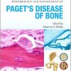 Advances in Pathobiology and Management of Paget’s Disease of Bone-Original PDF