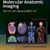 Molecular Anatomic Imaging: PET/CT, PET/MR and SPECT CT – EPUB
