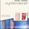 Operative Techniques: Total Knee Replacement, 1e-Original PDF