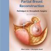 Partial Breast Reconstruction: Techniques in Oncoplastic Surgery, 2nd Edition – Original PDF+Videos