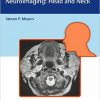 Differential Diagnosis in Neuroimaging: Head and Neck-Original PDF