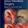 Clinical Maxillary Sinus Elevation Surgery-Original PDF