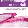 Histopathology of the Nail: Onychopathology-Original PDF