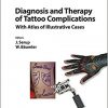 Diagnosis and Therapy of Tattoo Complications: With Atlas of Illustrative Cases (Current Problems in Dermatology, Vol. 52)-Original PDF