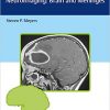 Differential Diagnosis in Neuroimaging: Brain and Meninges-Original PDF