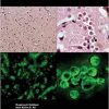 Brain-eating Amoebae: Biology and Pathogenesis of Naegleria fowleri-Original PDF