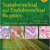 Transbronchial and Endobronchial Biopsies-Original PDF