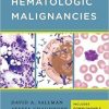 Handbook of Hematologic Malignancies-EPUB