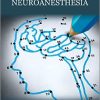 Complications in Neuroanesthesia-Original PDF