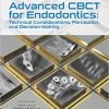 Advanced CBCT for Endodontics: Technical Considerations, Perception, and Decision-Making-Original PDF