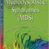 Myelodysplastic Syndromes: Risk Factors, Treatment and Prognosis-Original PDF