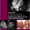 The Cardiac MRI in Diagnosis, Clinical Management, and Prognosis of Arrhythmogenic Right Ventricular Cardiomyopathy/Dysplasia-Original PDF