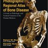 Photographic Regional Atlas of Bone Disease: A Guide to Pathologic and Normal Variations in the Human Skeleton-Original PDF