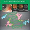 Anti-VEGF Use in Ophthalmology-Original PDF