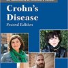 Questions And Answers About Crohn’s Disease (20 Questions & Answers About) 2nd Edition-Original PDF