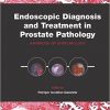 Endoscopic Diagnosis and Treatment in Prostate Pathology: Handbook of Endourology-Original PDF