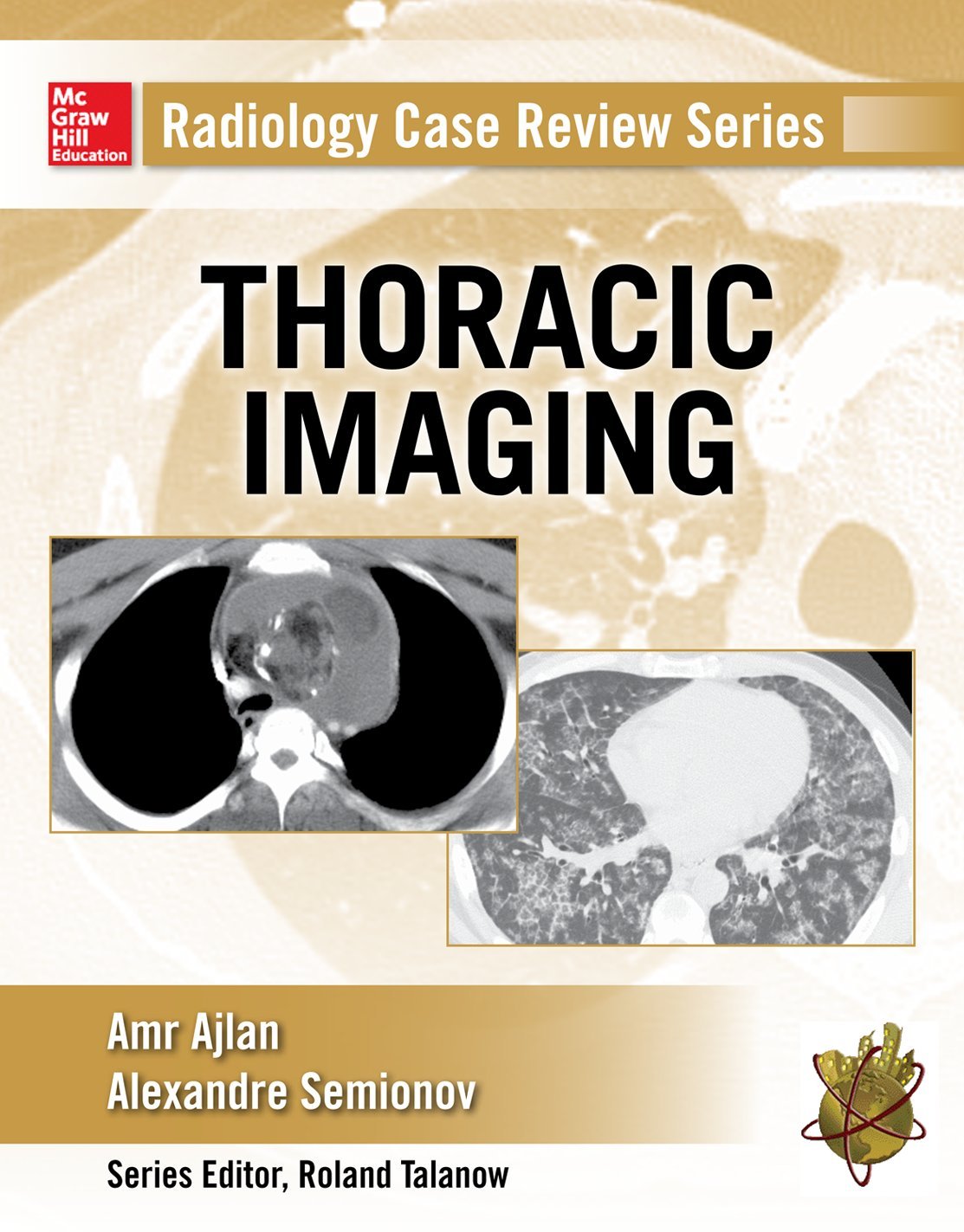 Radiology Case Review Series: Thoracic Imaging 1st Edition – PDF