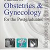 Manual of Obstetrics & Gynecology for the Postgraduates 2nd edition-Original PDF