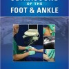 Ultrasound of the Foot and Ankle – EPUB