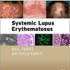 Systemic Lupus Erythematosus: Basic, Applied and Clinical Aspects – Original PDF