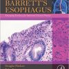 Barrett’s Esophagus: Emerging Evidence for Improved Clinical Practice – Original PDF