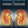 Biomarkers of Kidney Disease 2e – Original PDF