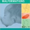 Common Malformations – Original PDF