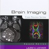 Brain Imaging Case Review Series, 2e – Original PDF