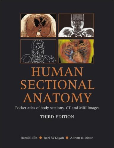 Human Sectional Anatomy Pocket Atlas of Body Sections, CT and MRI Images, Third Edition 3rd Edition – Original PDF