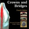 Planning and Making Crowns and Bridges – Original PDF