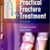 Practical Fracture Treatment, 5e