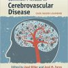 Common Pitfalls in Cerebrovascular Disease: Case-Based Learning – Original PDF