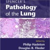 Spencer’s Pathology of the Lung 6th Edition – Original PDF