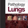 Pathology of the Lungs: Expert Consult: Online and Print, 3e – Original PDF