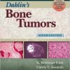 Dahlin’s Bone Tumors: General Aspects and Data on 10,165 Cases Sixth Edition – Original PDF