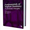 Fundamentals of Implant Dentistry: Surgical Principles Volume 2-Original PDF