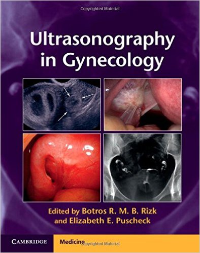 Ultrasonography in Gynecology – PDF