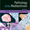 Pathology of the Mediastinum – EPUB