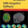 MRI-Negative Epilepsy: Evaluation and Surgical Management – Original PDF