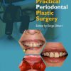 Practical Periodontal Plastic Surgery 2nd Edition – Original PDF
