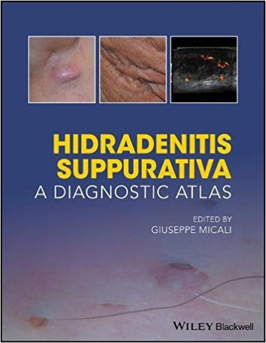 Hidradenitis Suppurativa : A Diagnostic Atlas – Original PDF - All ...