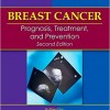 Breast Cancer: Prognosis, Treatment, and Prevention 2nd Edition – Original PDF