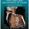 Forensic Pathology of Fractures and Mechanisms of Injury: Postmortem CT Scanning – Original PDF