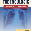 Clinical Tuberculosis: A Practical Handbook – Original PDF