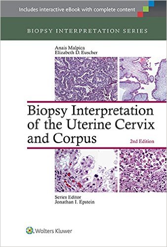 Biopsy Interpretation of the Uterine Cervix and Corpus (Biopsy Interpretation Series) Second Edition – EPUB
