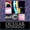 Ocular Pathology, 7th Edition – PDF