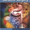 Nutrition and Bariatric Surgery – Original PDF