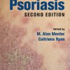 Psoriasis 2nd Edition – Original PDF